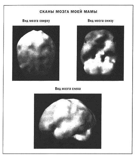 Иллюстрация к книге — Мозг и душа. Новые открытия о влиянии мозга на характер, чувства, эмоции [i_009.jpg]