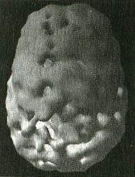 Иллюстрация к книге — Мозг и любовь. Секреты практической нейробиологии [i_004.jpg]