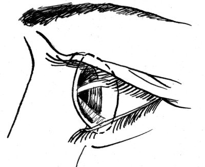 Иллюстрация к книге — 36 и 6 правил здоровых глаз [i_006.jpg]