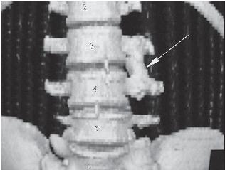 Иллюстрация к книге — Остеохондроз для профессионального пациента [i_007.jpg]