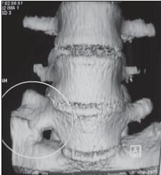 Иллюстрация к книге — Остеохондроз для профессионального пациента [i_008.jpg]