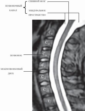 Иллюстрация к книге — Остеохондроз для профессионального пациента [i_010.jpg]