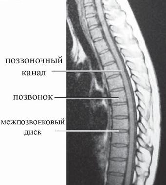 Иллюстрация к книге — Остеохондроз для профессионального пациента [i_015.jpg]