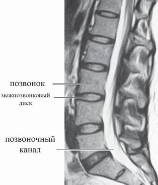 Иллюстрация к книге — Остеохондроз для профессионального пациента [i_017.jpg]