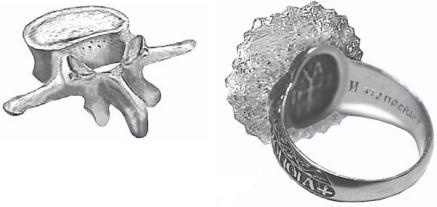 Иллюстрация к книге — Остеохондроз для профессионального пациента [i_021.jpg]