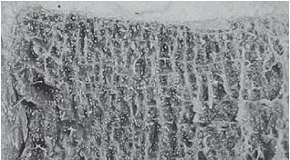 Иллюстрация к книге — Остеохондроз для профессионального пациента [i_022.jpg]