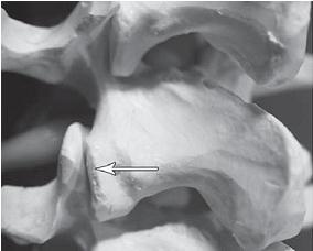 Иллюстрация к книге — Остеохондроз для профессионального пациента [i_025.jpg]