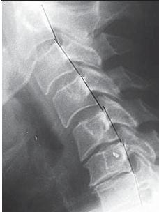 Иллюстрация к книге — Остеохондроз для профессионального пациента [i_038.jpg]