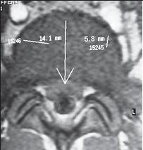 Иллюстрация к книге — Остеохондроз для профессионального пациента [i_043.jpg]