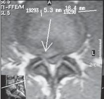 Иллюстрация к книге — Остеохондроз для профессионального пациента [i_046.jpg]