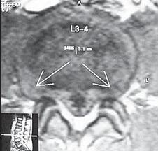 Иллюстрация к книге — Остеохондроз для профессионального пациента [i_047.jpg]