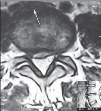 Иллюстрация к книге — Остеохондроз для профессионального пациента [i_048.jpg]