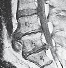 Иллюстрация к книге — Остеохондроз для профессионального пациента [i_050.jpg]