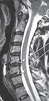 Иллюстрация к книге — Остеохондроз для профессионального пациента [i_052.jpg]