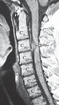 Иллюстрация к книге — Остеохондроз для профессионального пациента [i_053.jpg]