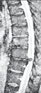 Иллюстрация к книге — Остеохондроз для профессионального пациента [i_054.jpg]