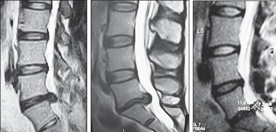 Иллюстрация к книге — Остеохондроз для профессионального пациента [i_056.jpg]