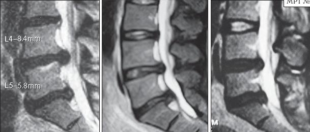 Иллюстрация к книге — Остеохондроз для профессионального пациента [i_057.jpg]