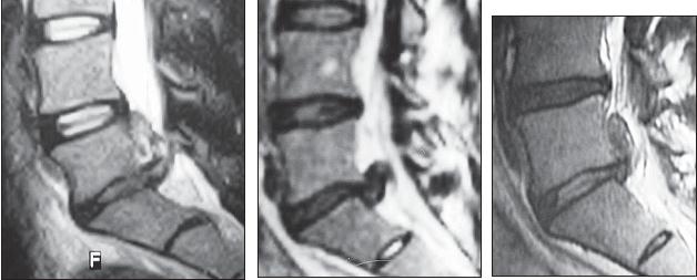 Иллюстрация к книге — Остеохондроз для профессионального пациента [i_059.jpg]