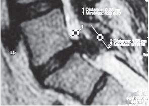 Иллюстрация к книге — Остеохондроз для профессионального пациента [i_060.jpg]
