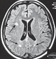Иллюстрация к книге — Остеохондроз для профессионального пациента [i_065.jpg]