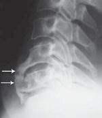 Иллюстрация к книге — Остеохондроз для профессионального пациента [i_070.jpg]