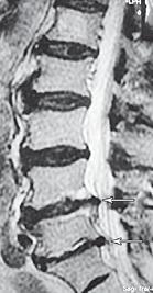 Иллюстрация к книге — Остеохондроз для профессионального пациента [i_075.jpg]