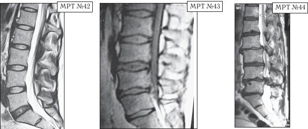 Иллюстрация к книге — Остеохондроз для профессионального пациента [i_076.jpg]