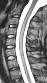 Иллюстрация к книге — Остеохондроз для профессионального пациента [i_078.jpg]