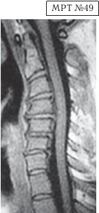 Иллюстрация к книге — Остеохондроз для профессионального пациента [i_081.jpg]