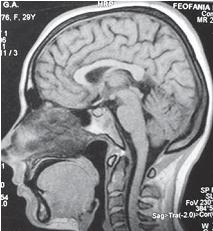 Иллюстрация к книге — Остеохондроз для профессионального пациента [i_082.jpg]
