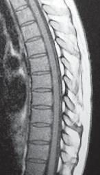 Иллюстрация к книге — Остеохондроз для профессионального пациента [i_083.jpg]