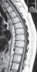Иллюстрация к книге — Остеохондроз для профессионального пациента [i_084.jpg]