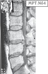 Иллюстрация к книге — Остеохондроз для профессионального пациента [i_086.jpg]