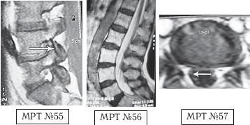 Иллюстрация к книге — Остеохондроз для профессионального пациента [i_087.jpg]