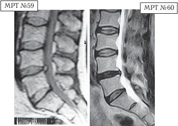Иллюстрация к книге — Остеохондроз для профессионального пациента [i_089.jpg]