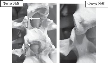 Иллюстрация к книге — Остеохондроз для профессионального пациента [i_092.jpg]