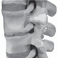 Иллюстрация к книге — Остеохондроз для профессионального пациента [i_094.jpg]
