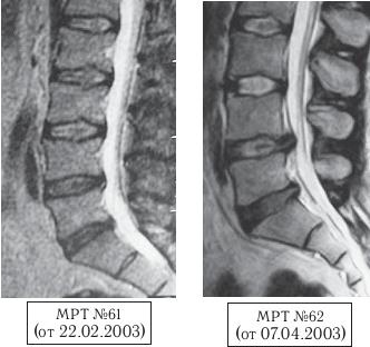 Иллюстрация к книге — Остеохондроз для профессионального пациента [i_096.jpg]