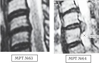 Иллюстрация к книге — Остеохондроз для профессионального пациента [i_097.jpg]