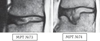 Иллюстрация к книге — Остеохондроз для профессионального пациента [i_107.jpg]