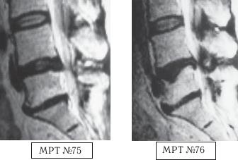 Иллюстрация к книге — Остеохондроз для профессионального пациента [i_108.jpg]