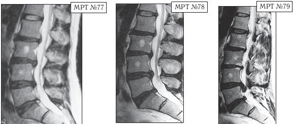 Иллюстрация к книге — Остеохондроз для профессионального пациента [i_109.jpg]