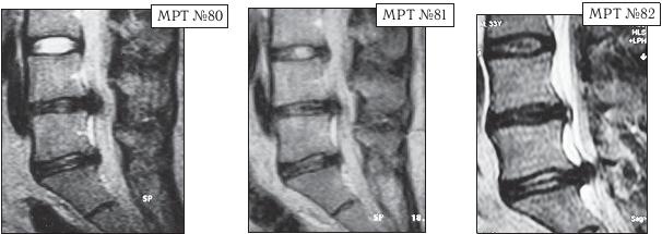 Иллюстрация к книге — Остеохондроз для профессионального пациента [i_110.jpg]