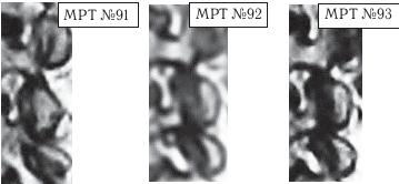 Иллюстрация к книге — Остеохондроз для профессионального пациента [i_113.jpg]