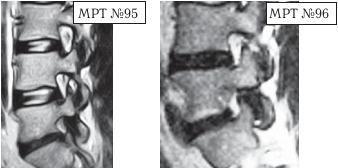 Иллюстрация к книге — Остеохондроз для профессионального пациента [i_115.jpg]