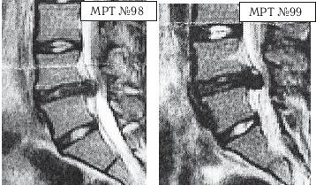 Иллюстрация к книге — Остеохондроз для профессионального пациента [i_117.jpg]