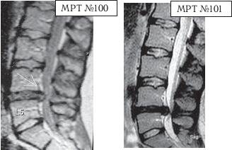 Иллюстрация к книге — Остеохондроз для профессионального пациента [i_118.jpg]