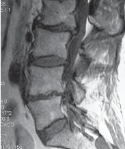 Иллюстрация к книге — Остеохондроз для профессионального пациента [i_119.jpg]