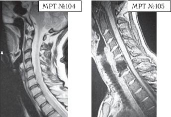 Иллюстрация к книге — Остеохондроз для профессионального пациента [i_121.jpg]